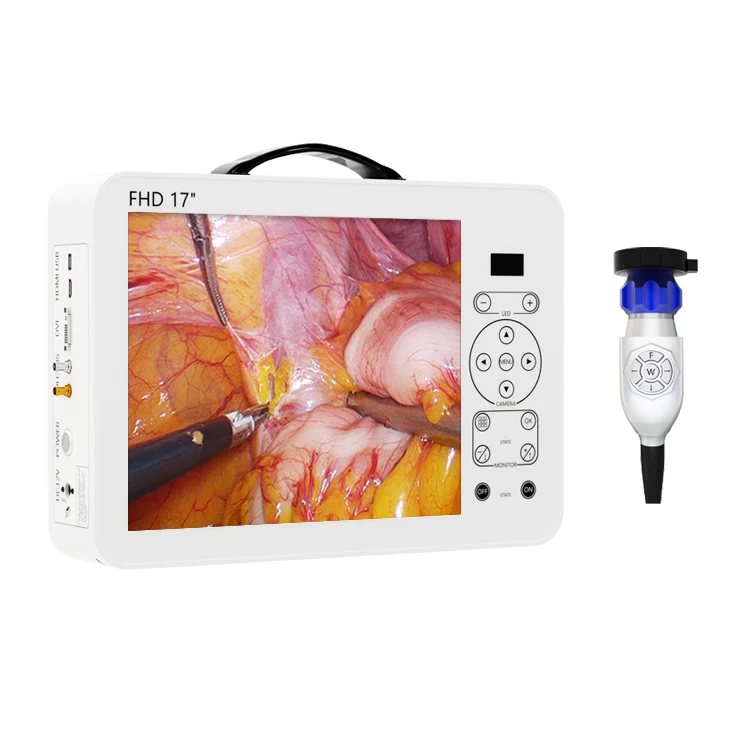 17 İnç HD Video Otoskop KBB Te - Medical Lab Images incelemesi ve fiyatı